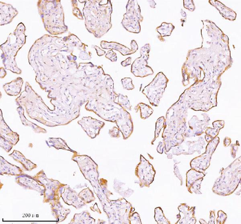 Anti-TNIK Antibody