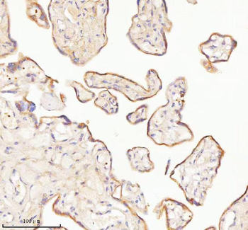 Anti-TNIK Antibody