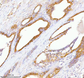 Anti-TNIK Antibody