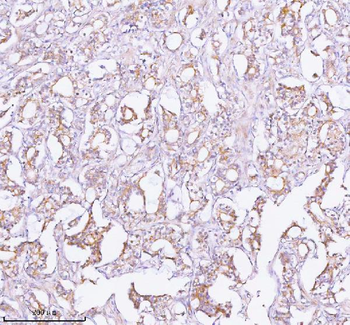Anti-TNIK Antibody