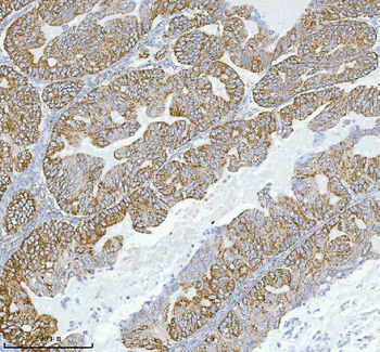 Anti-HERP/HERPUD1 Antibody