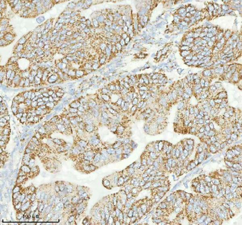 Anti-HERP/HERPUD1 Antibody
