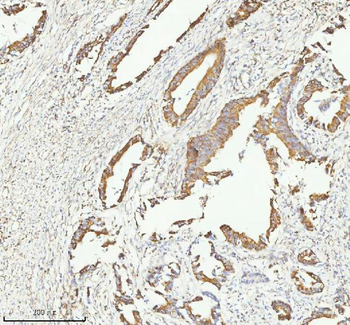 Anti-HERP/HERPUD1 Antibody