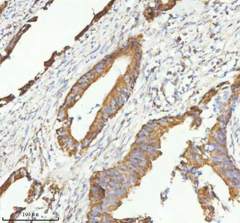 Anti-HERP/HERPUD1 Antibody