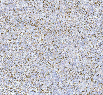 Anti-HERP/HERPUD1 Antibody