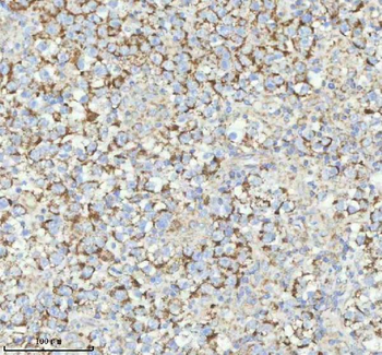 Anti-HERP/HERPUD1 Antibody