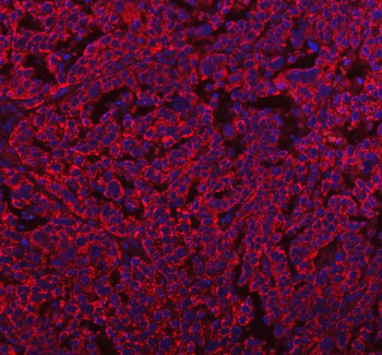 Anti-HERP/HERPUD1 Antibody