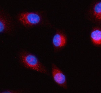 Anti-HERP/HERPUD1 Antibody