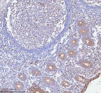Anti-HERP/HERPUD1 Antibody