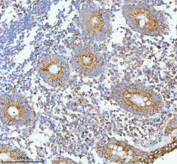 Anti-HERP/HERPUD1 Antibody