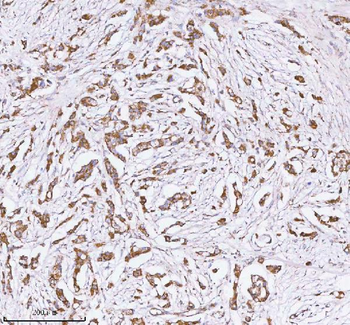 Anti-HERP/HERPUD1 Antibody