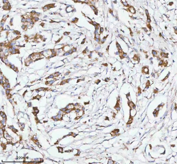 Anti-HERP/HERPUD1 Antibody