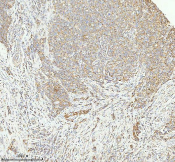 Anti-HERP/HERPUD1 Antibody