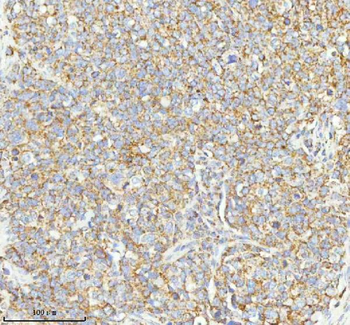 Anti-HERP/HERPUD1 Antibody