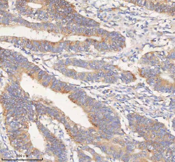 Anti-ERBB4 Antibody