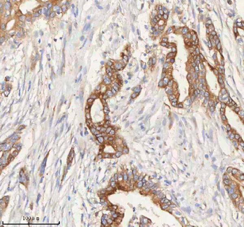 Anti-ERBB4 Antibody