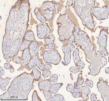 Anti-ERBB4 Antibody