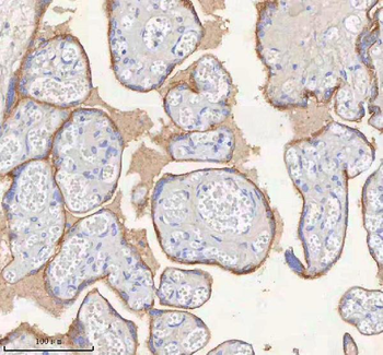 Anti-ERBB4 Antibody