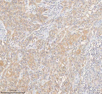 Anti-ERBB4 Antibody