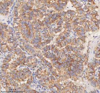 Anti-STIM1 Antibody