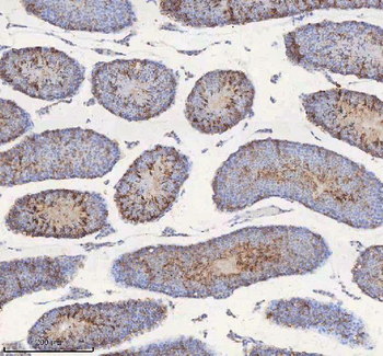 Anti-STIM1 Antibody