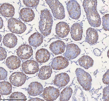 Anti-STIM1 Antibody