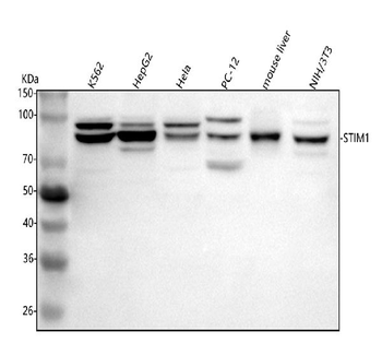 Anti-STIM1 Antibody
