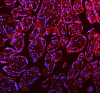 Anti-STIM1 Antibody