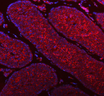 Anti-STIM1 Antibody