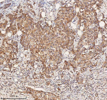 Anti-STIM1 Antibody