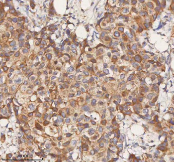 Anti-STIM1 Antibody