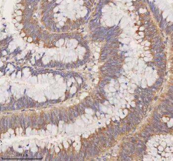 Anti-STIM1 Antibody