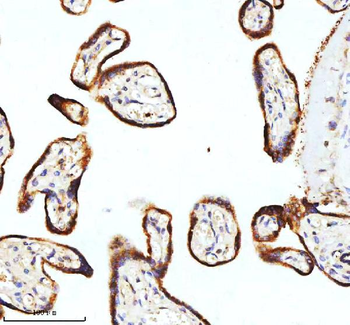 Anti-STIM1 Antibody