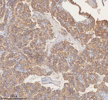 Anti-STIM1 Antibody