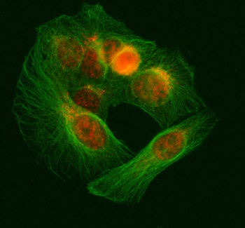 Anti-SNRNP70 Antibody