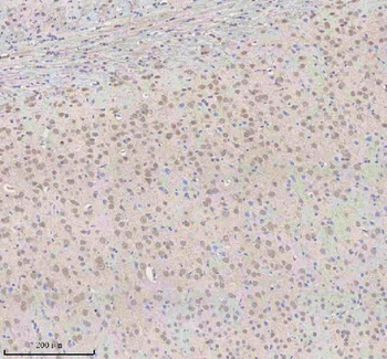 Anti-SNRNP70 Antibody