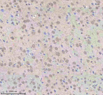 Anti-SNRNP70 Antibody