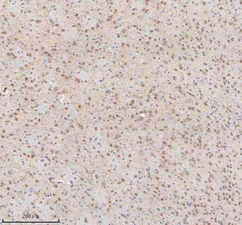 Anti-SNRNP70 Antibody