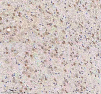 Anti-SNRNP70 Antibody