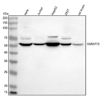 Anti-SNRNP70 Antibody