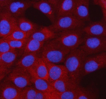 Anti-SMTNL2 Antibody