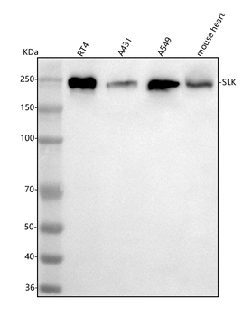 Anti-SLK Antibody