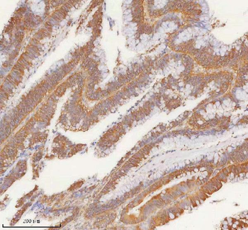 Anti-SLK Antibody