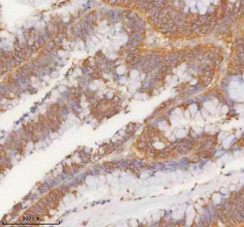 Anti-SLK Antibody