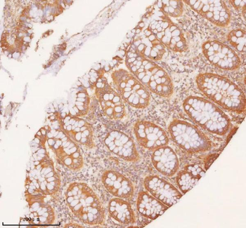 Anti-SLK Antibody