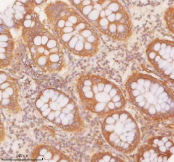 Anti-SLK Antibody