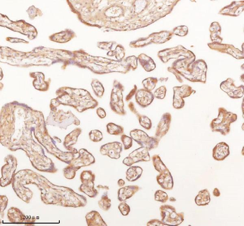 Anti-SLK Antibody