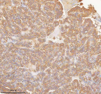 Anti-SLK Antibody