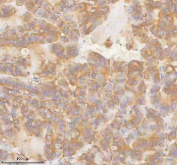 Anti-SLK Antibody