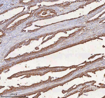 Anti-SLC6A20 Antibody